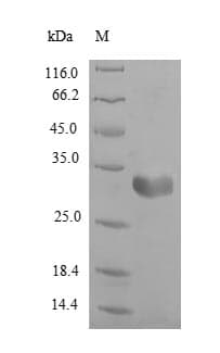 Rat FABP3 / H-FABP Protein (Recombinant 6His-SUMO, N-terminus)