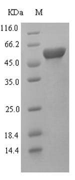 Human LAMA5 / Laminin Alpha 5 Protein (Recombinant 6His-SUMO, N-terminus)