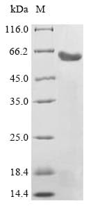 Dog LHB / Luteinizing Hormone Protein (Recombinant 6His, N-terminus)