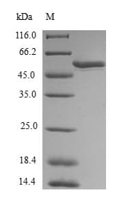 Human MGLL / Monoacylglycerol Lipase Protein (Recombinant GST, N-terminus)