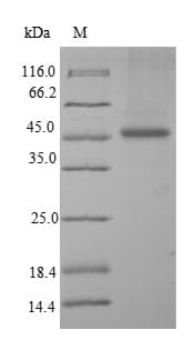 Human PDCD5 Protein (Recombinant GST, N-terminus)