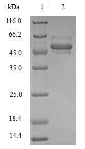 Human PPP1CB Protein (Recombinant 6His, N-terminus)