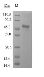 Cow SEPP1 / Selenoprotein P (Recombinant GST, N-terminus)