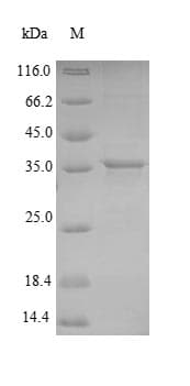 Mycobacterium tuberculosis Adenylate Kinase Protein (Recombinant 6His-SUMO, N-terminus)