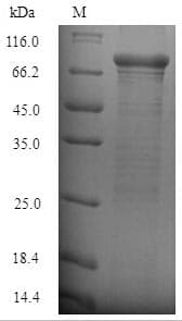 Staphylococcus aureus clfB Protein (Recombinant 6His-SUMO, N-terminus)