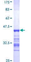 Human ACTN4 Protein (Recombinant GST, N-terminus)