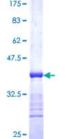 Human ACVR1B / ALK4 Protein (Recombinant GST, N-terminus)
