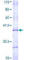 Human CPT1B Protein (Recombinant GST, N-terminus)