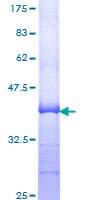 Human CPT2 Protein (Recombinant GST, N-terminus)
