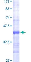 Human FASN / Fatty Acid Synthase Protein (Recombinant GST, N-terminus)