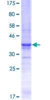 Human LAMA5 / Laminin Alpha 5 Protein (Recombinant GST, N-terminus)
