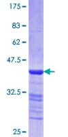 Human MYH3 Protein (Recombinant GST, N-terminus)