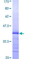 Human MYH9 Protein (Recombinant GST, N-terminus)