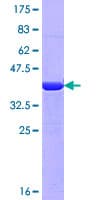 Human MYH9 Protein (Recombinant GST, N-terminus)