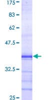 Human PKD2 / Polycystin 2 Protein (Recombinant GST, N-terminus)
