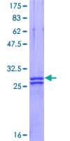 Human PLP1 / Myelin PLP Protein (Recombinant GST, N-terminus)
