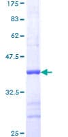 Human MAP2K1 / MKK1 / MEK1 Protein (Recombinant GST, N-terminus)