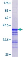 Human STK3 Protein (Recombinant GST, N-terminus)