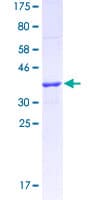 Human HNF1A / HNF1 Protein (Recombinant GST, N-terminus)