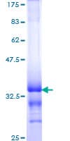 Human TOP1 / Topoisomerase I Protein (Recombinant GST, N-terminus)
