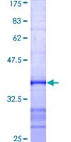 Human E6AP / UBE3A Protein (Recombinant GST, N-terminus)