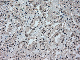 TSC501 / NAT8 Antibody (clone OTI6H3)