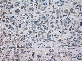 TSC501 / NAT8 Antibody (clone OTI6H3)