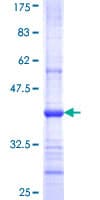 Human GDF3 Protein (Recombinant GST, N-terminus)