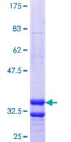Human SLC17A4 Protein (Recombinant GST, N-terminus)