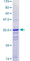 Human KLF2 Protein (Recombinant GST, N-terminus)
