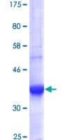 Human PDE10A Protein (Recombinant GST, N-terminus)
