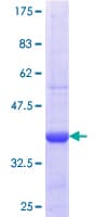 Human Sulfatase 1 / SULF1 Protein (Recombinant GST, N-terminus)