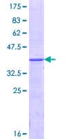 Human UGT1A / UGT1A1 Protein (Recombinant GST, N-terminus)