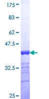Human SALL4 Protein (Recombinant GST, N-terminus)