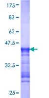 Human RIOK1 Protein (Recombinant GST, N-terminus)