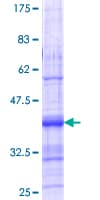 Human ACVR1C / ALK7 Protein (Recombinant GST, N-terminus)