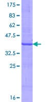 Human NUDT14 Protein (Recombinant GST, N-terminus)