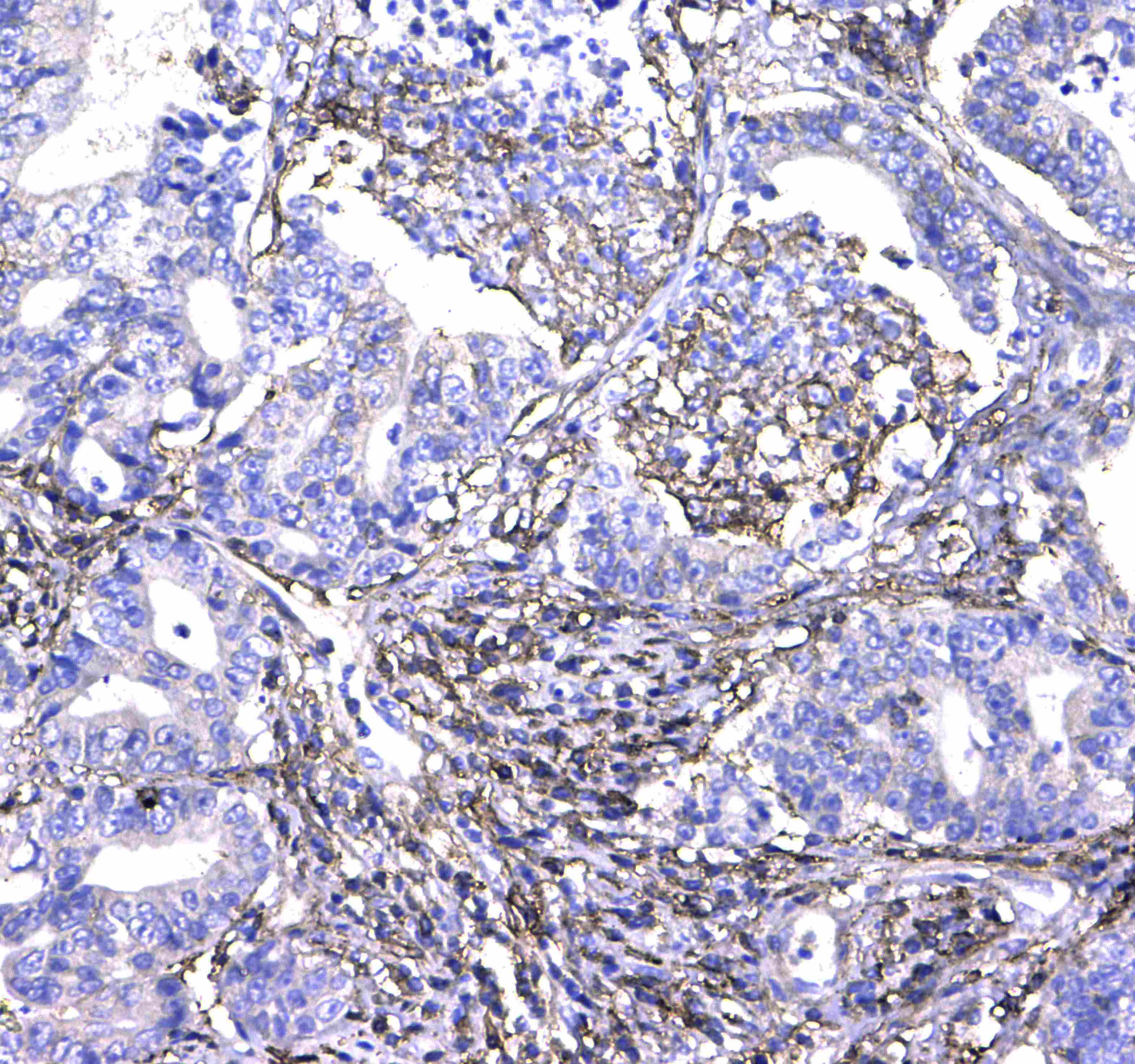 CD44 Antibody