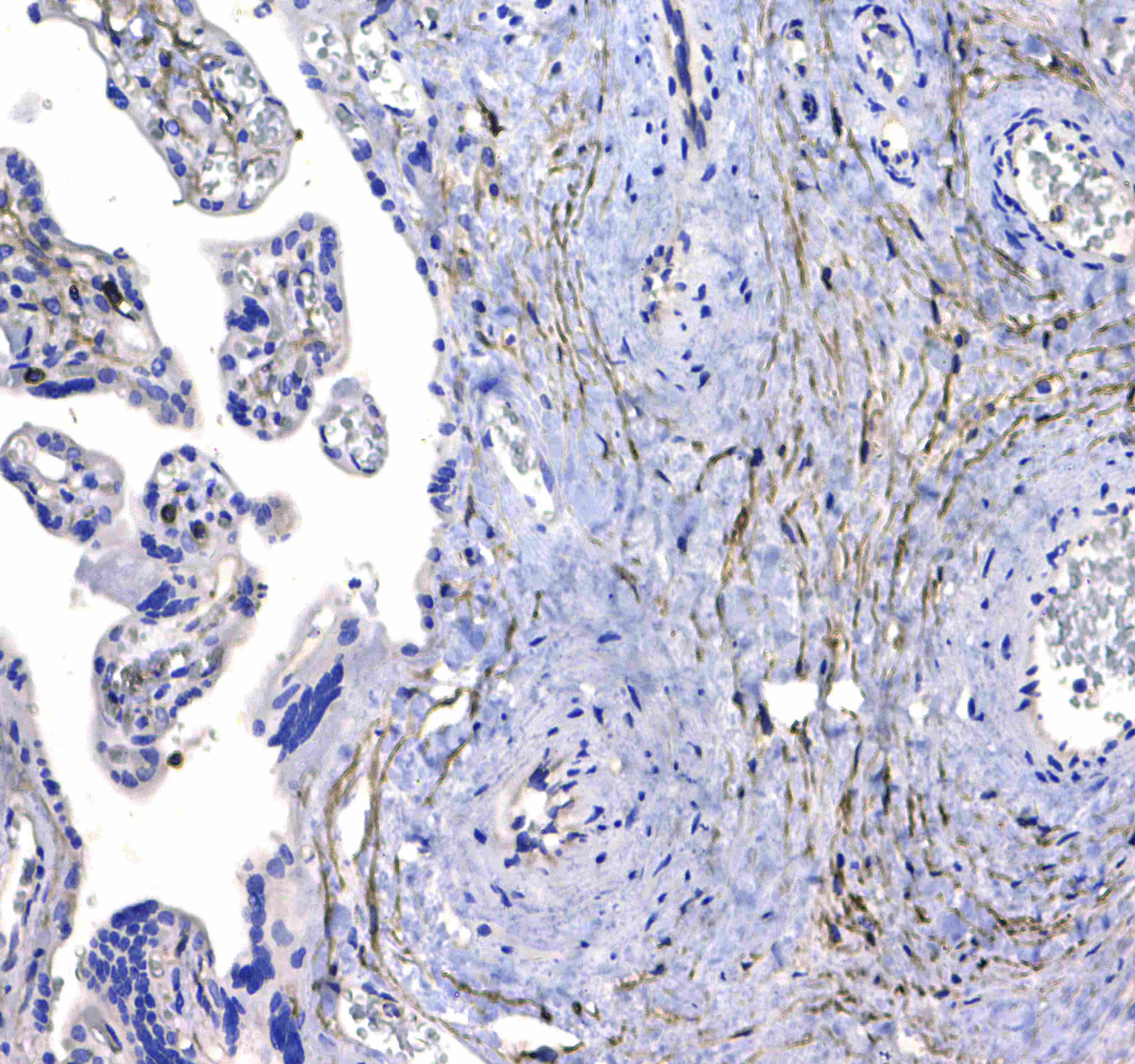 CD44 Antibody