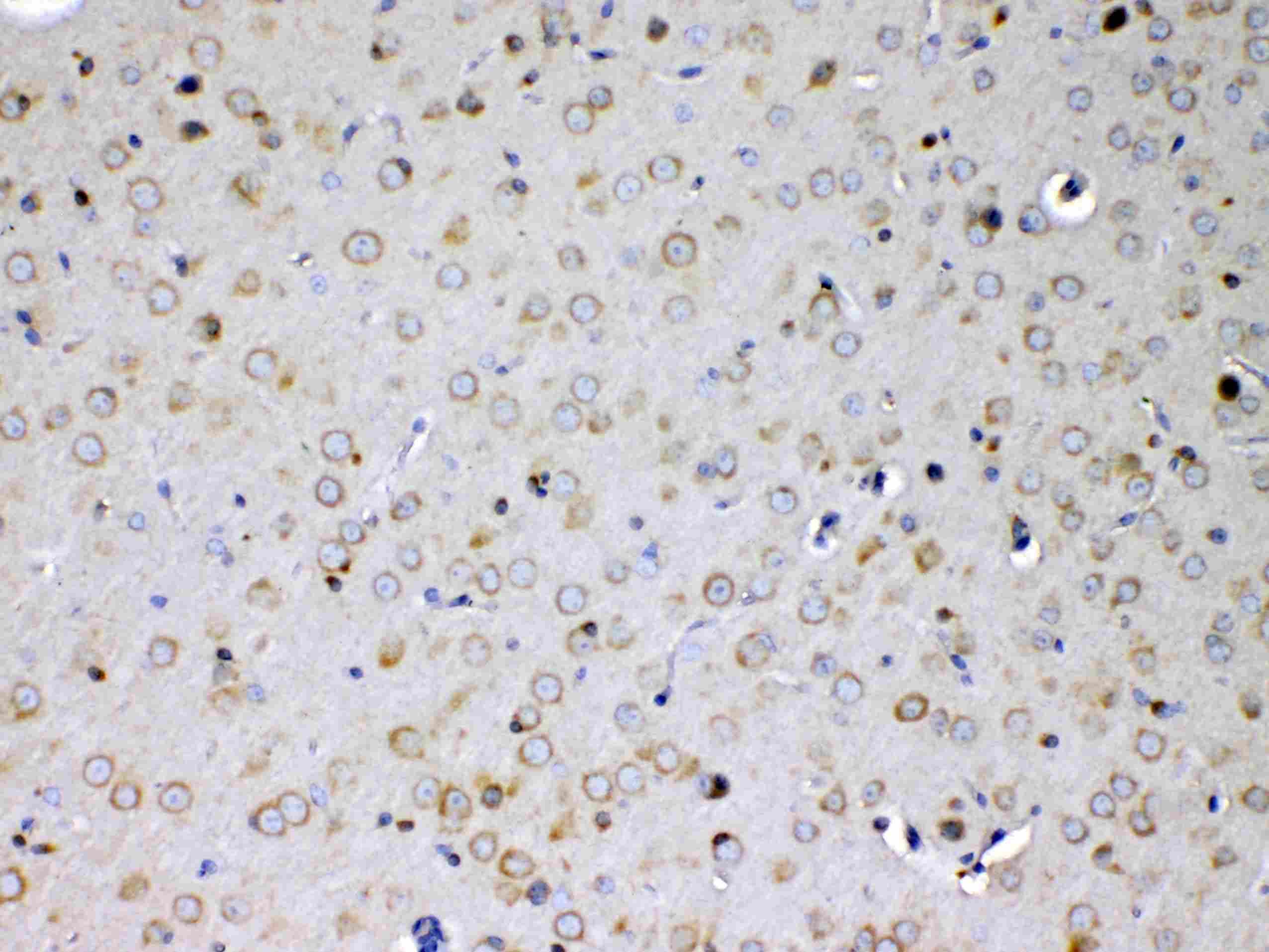 IL15RA Antibody
