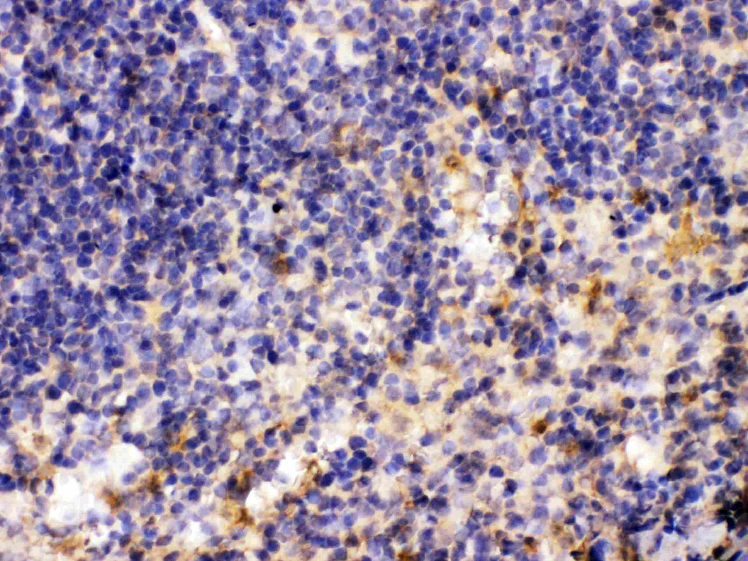 MMP11 Antibody