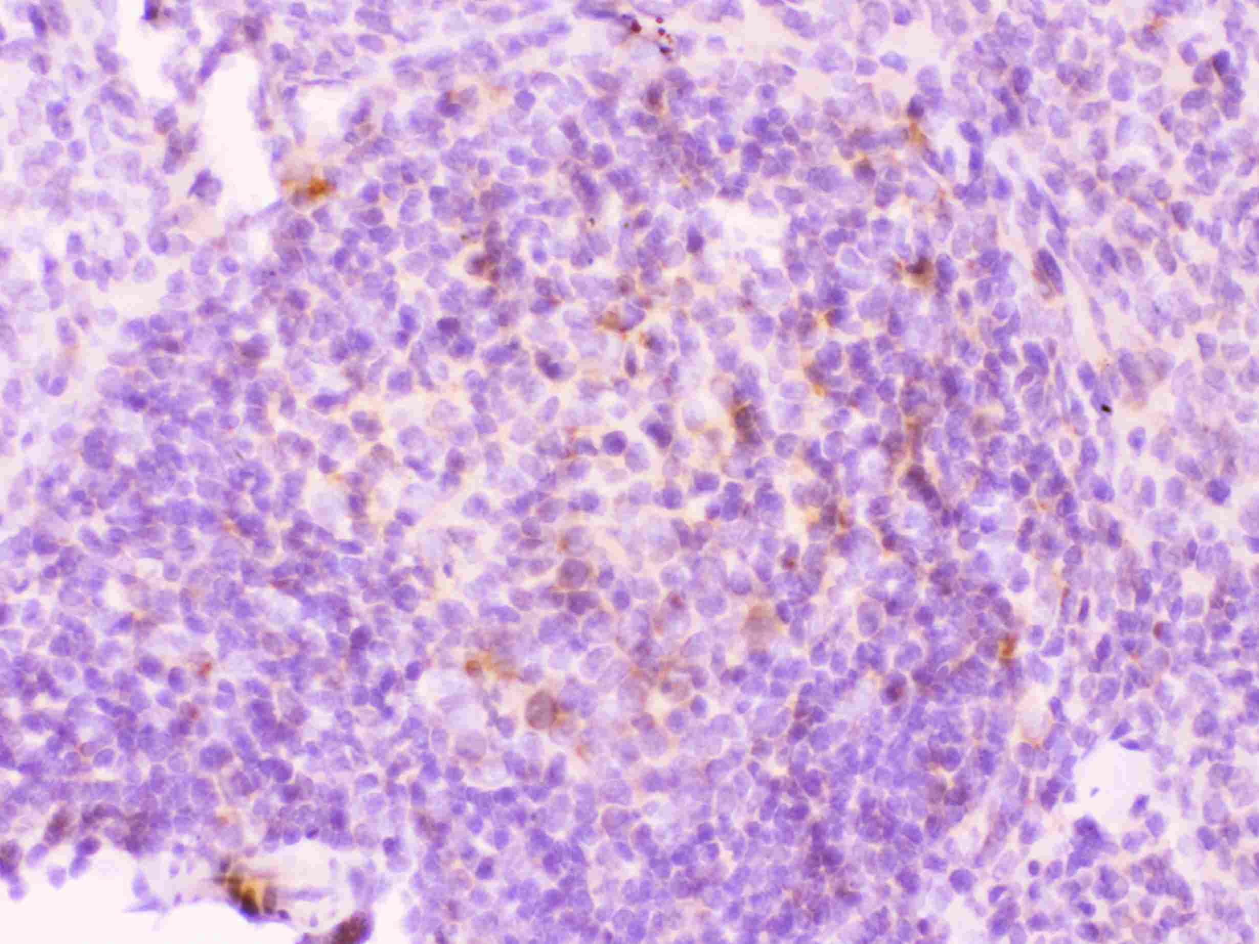 MMP11 Antibody