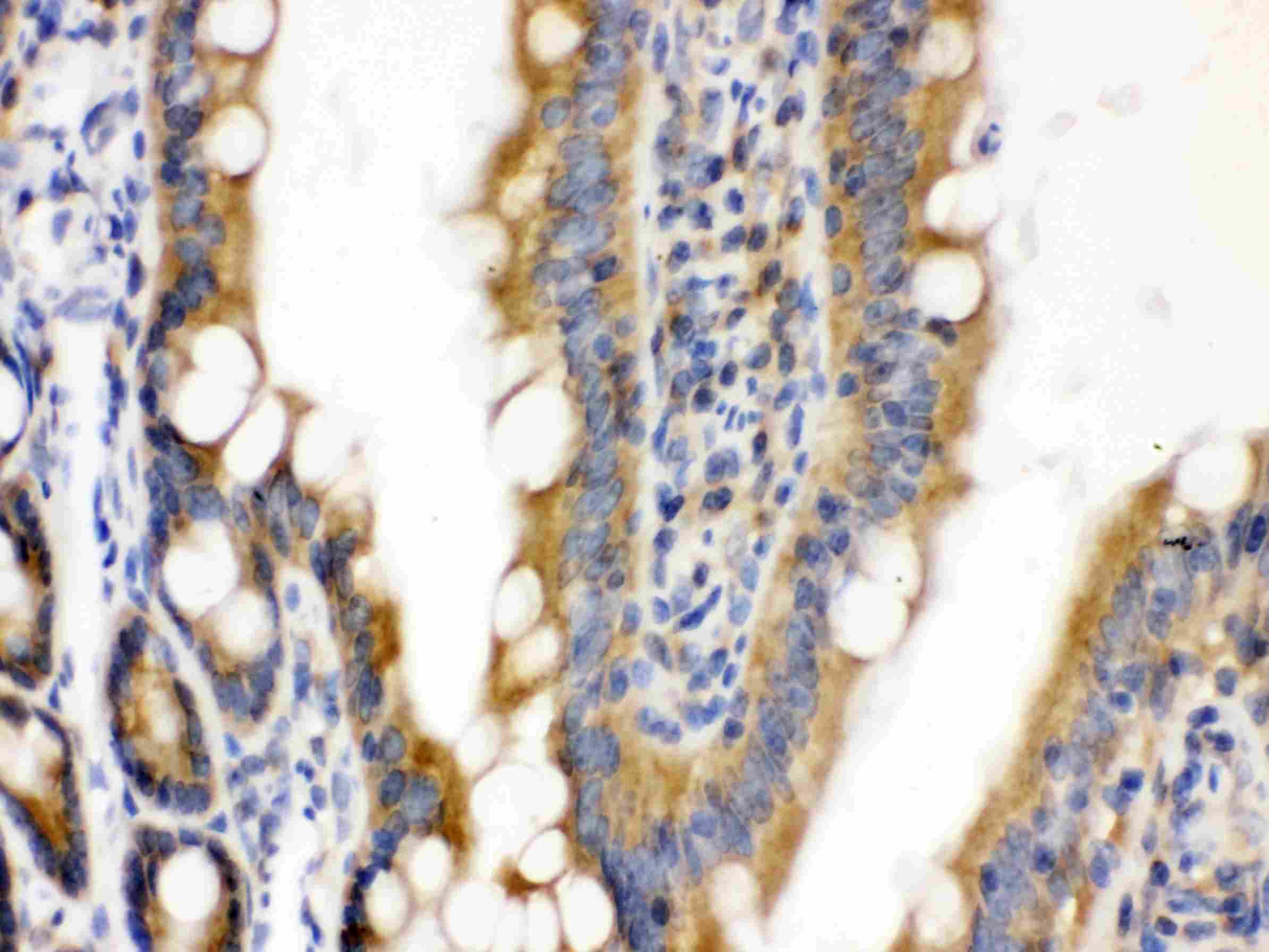 CDCP1 Antibody