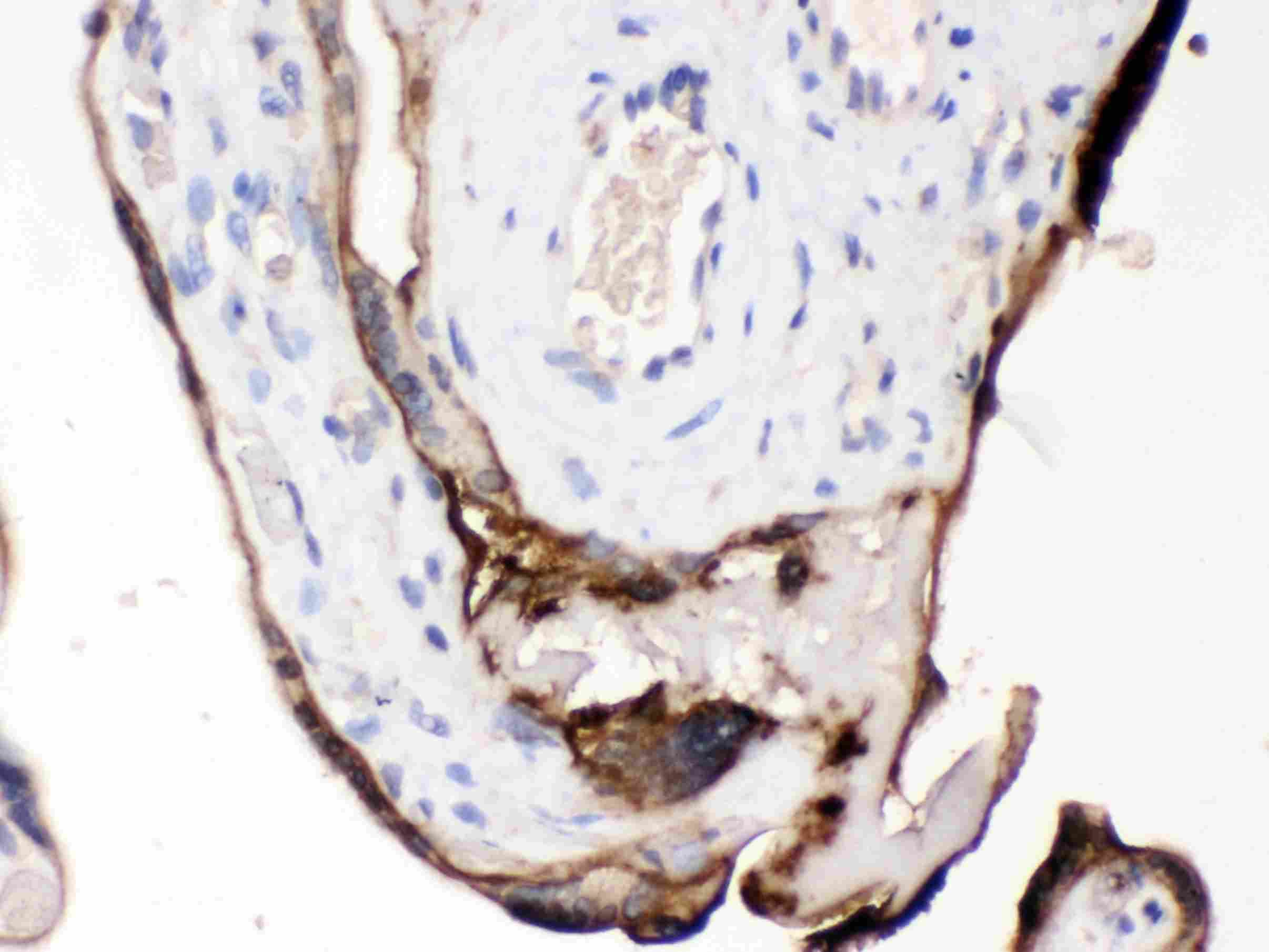 CDCP1 Antibody