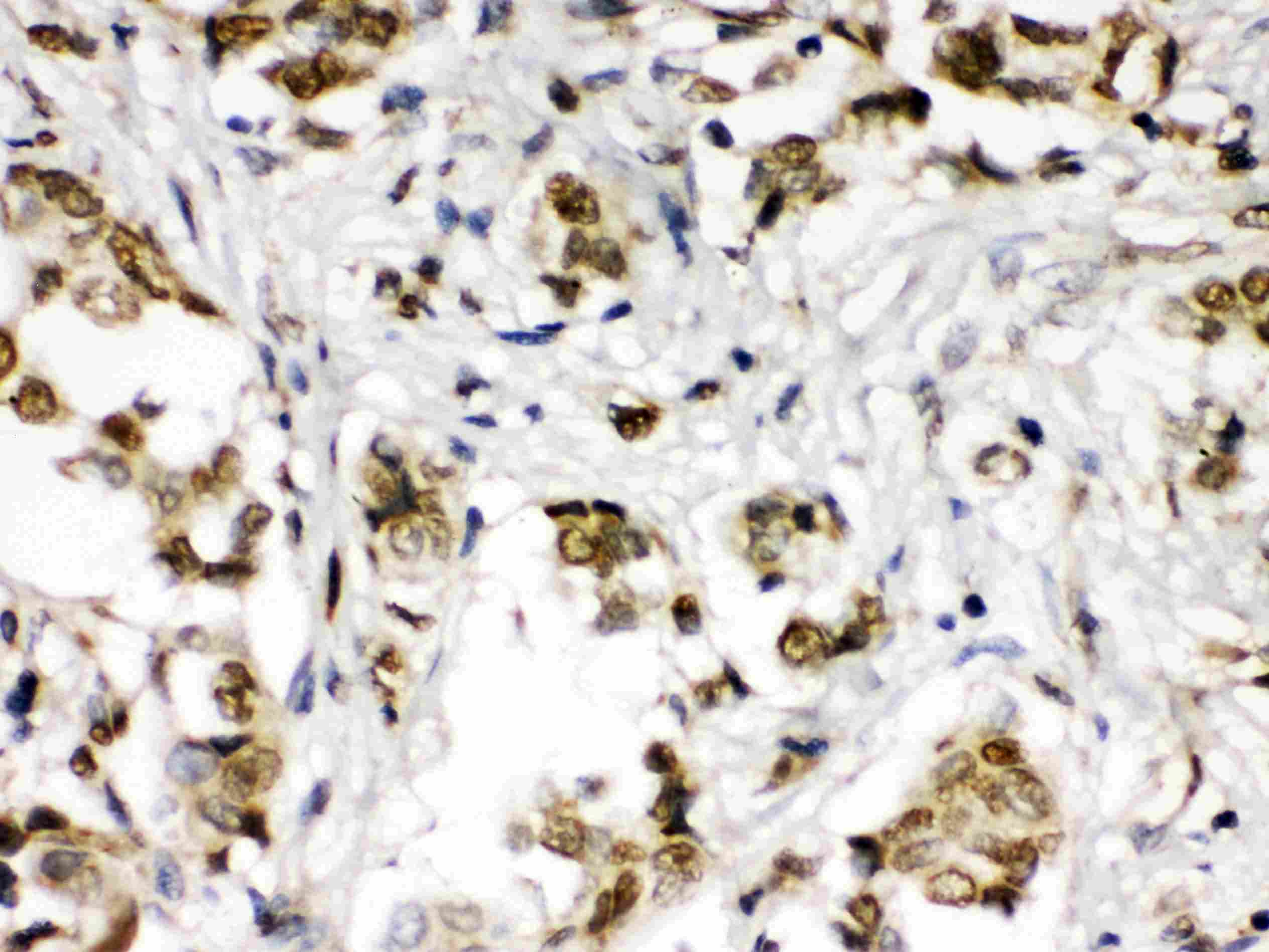 ABR Antibody