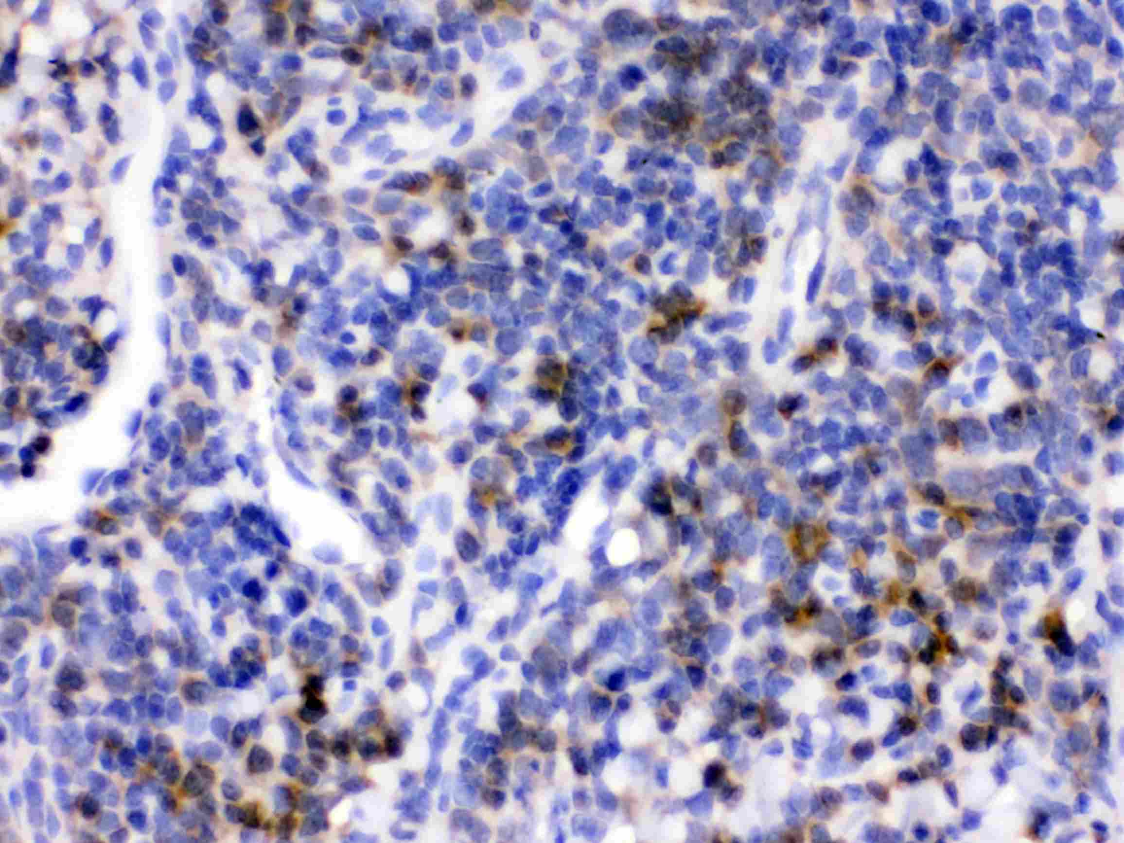 CD33 Antibody
