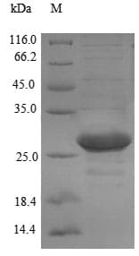 Prochlorothrix hollandica petE Protein (Recombinant 6His-SUMO, N-terminus)