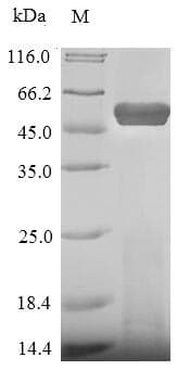 Staphylococcus aureus lukF Protein (Recombinant 10His-SUMO, N-terminus + Myc, C-terminus)