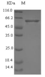 Staphylococcus aureus Enolase Protein (Recombinant 6His-SUMO, N-terminus)