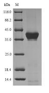 Staphylococcus aureus clfA Protein (Recombinant 10His, N-terminus)
